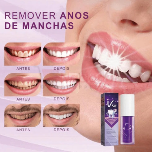 Clareador Dental V34