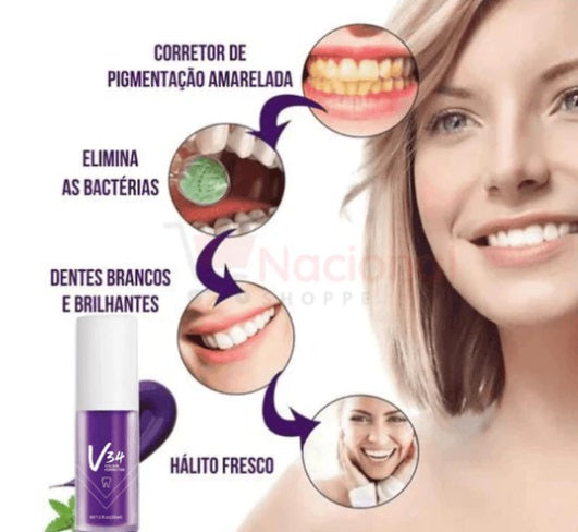 Facetas Dentárias Removíveis