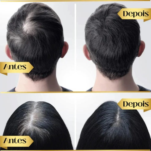 Tônico Capilar Repair Hair®